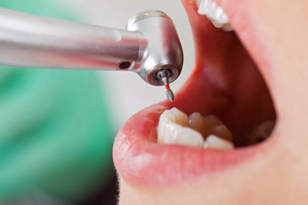 Best Emergency Treatment for Toothache in Kaunakakai, HI